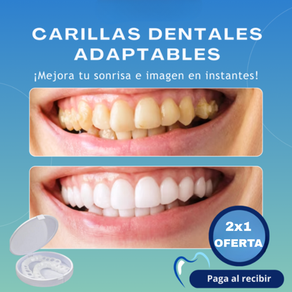 😱OFERTA EXCLUSIVA 2X1😱 Carillas Dentales Adaptables - Transforma tu Sonrisa