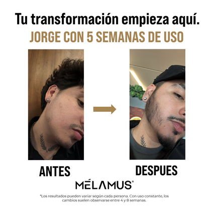 Bálsamo Mélamus - Minoxidil 20%
