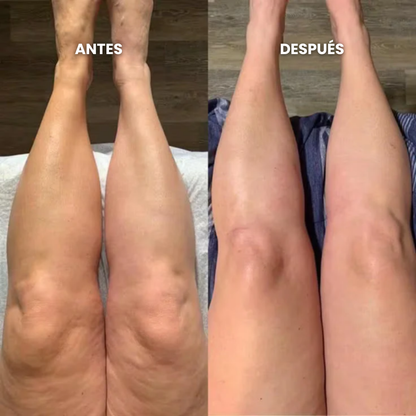 Gotas de Bienestar para Drenaje Linfático