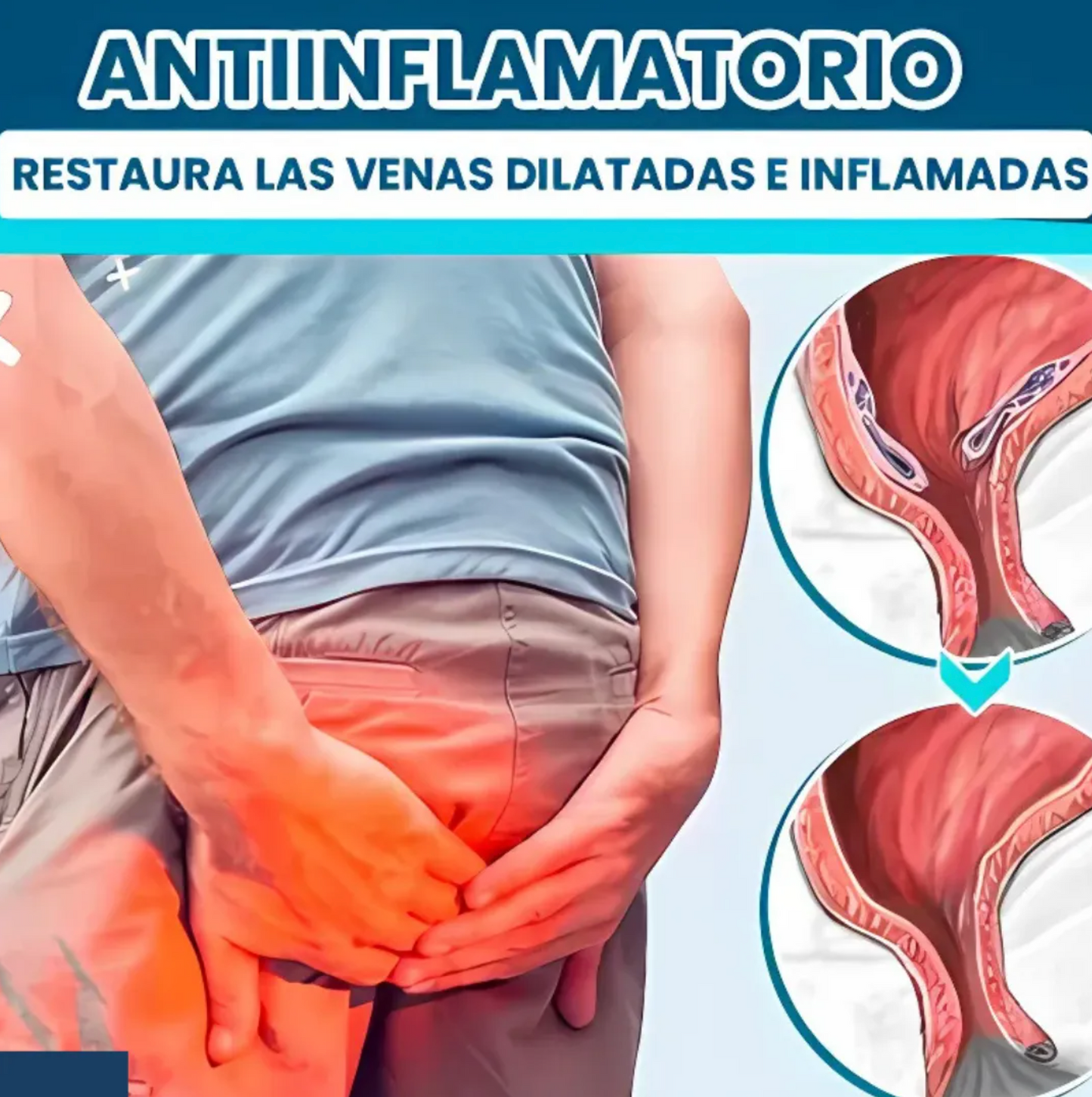 Dictamin - Alivia y reduce las hemorroides eficazmente